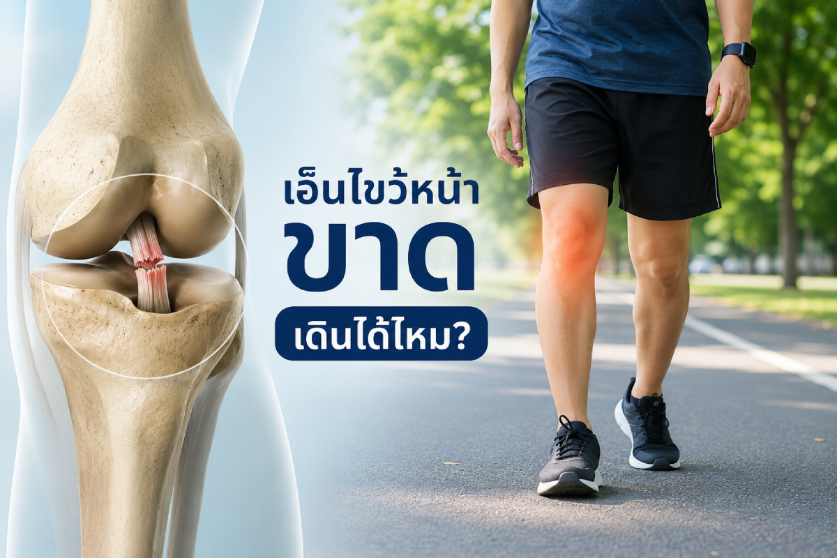 เอ็นไขว้หน้าขาด เดินได้ไหม?