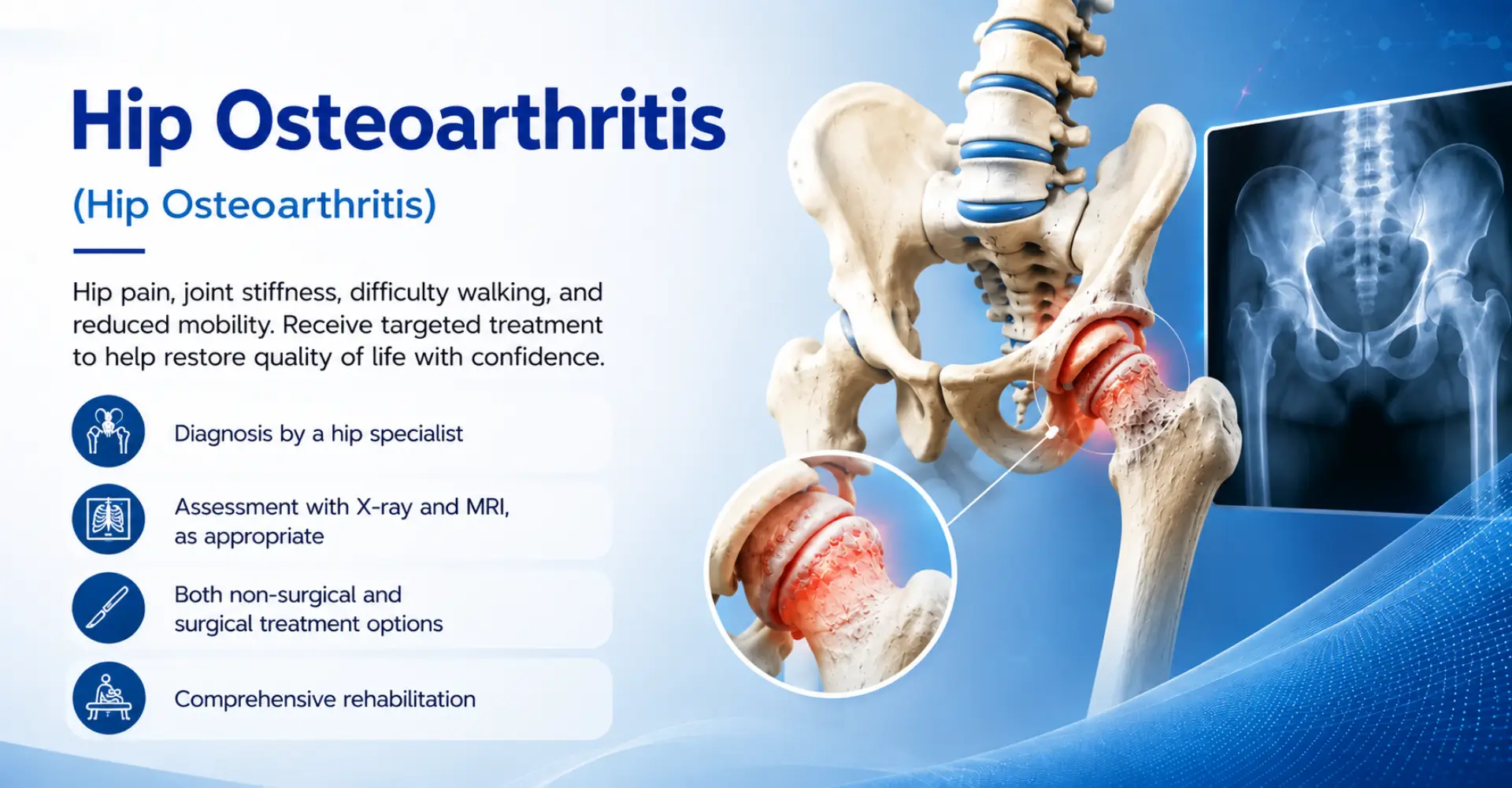 Hip Osteoarthritis