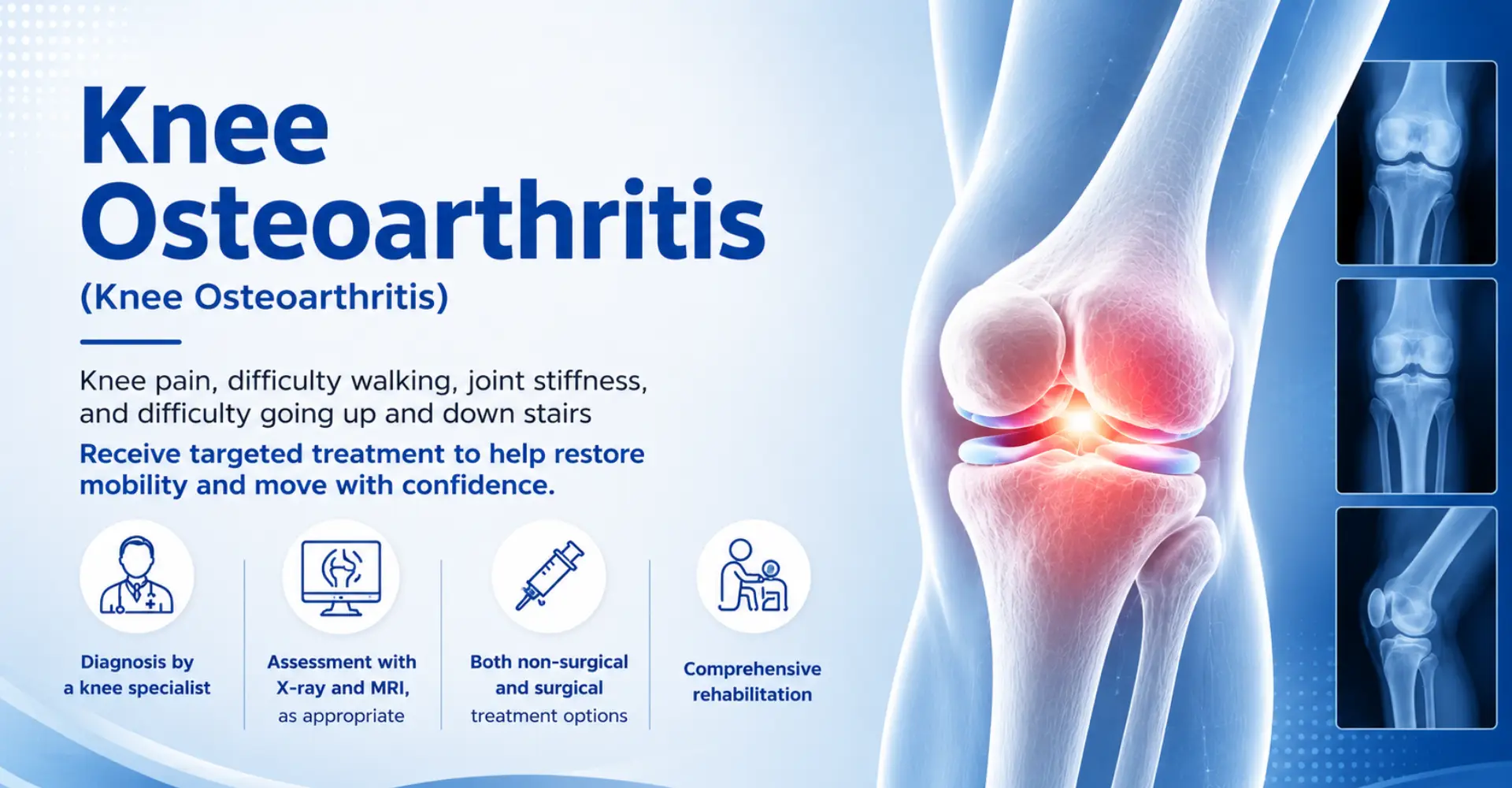 Knee Osteoarthritis