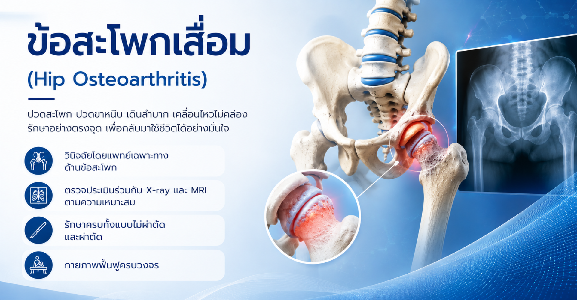 ข้อสะโพกเสื่อม โรคนี้คืออะไร