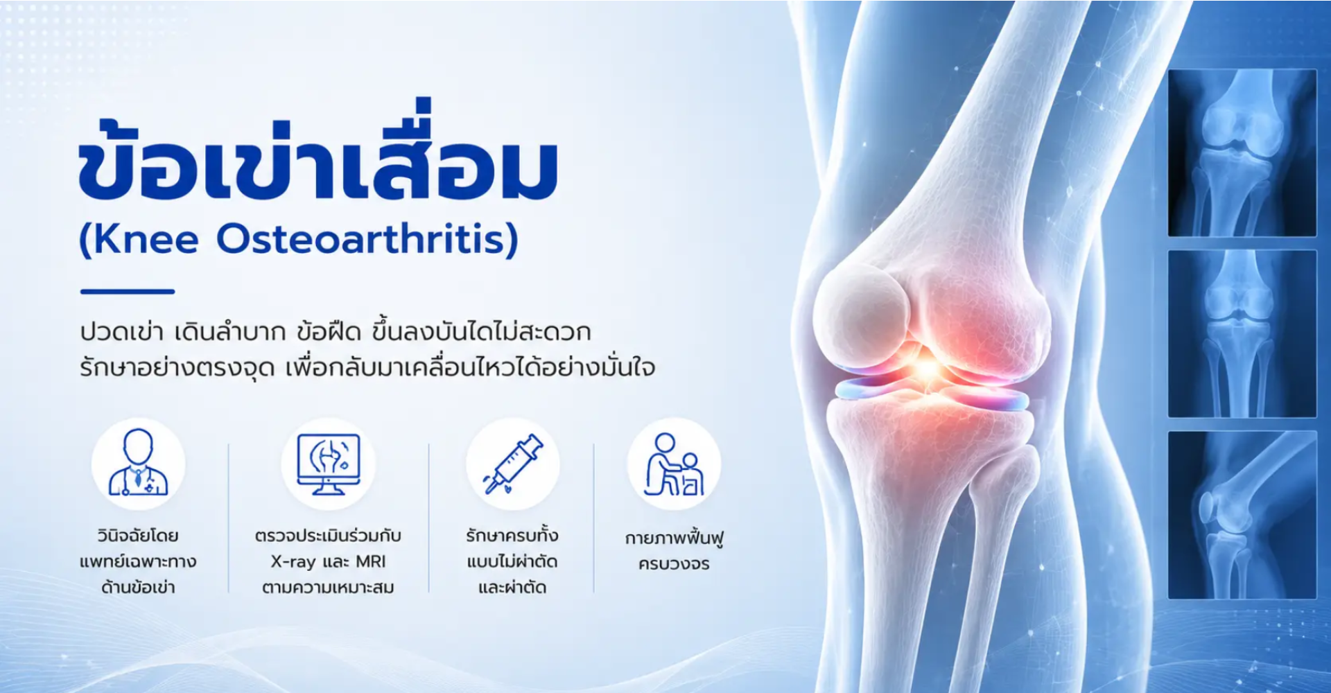 ข้อเข่าเสื่อม