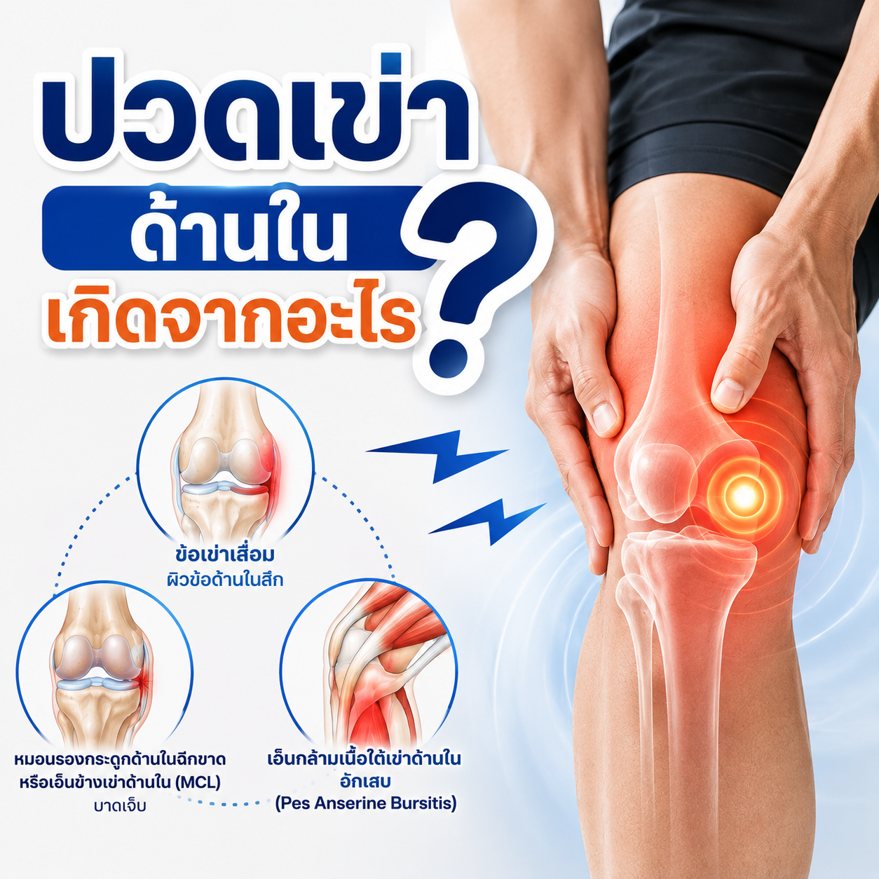 ปวดเข่าด้านในเกิดจากอะไร