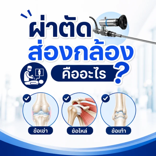 ผ่าตัดส่องกล้องคืออะไร
